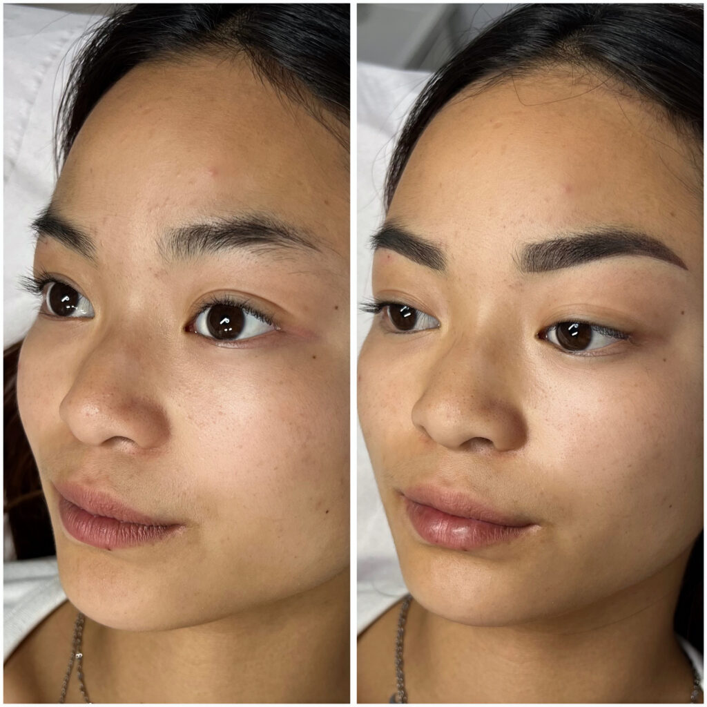 Corrección cejas despobladas con micropigmentación