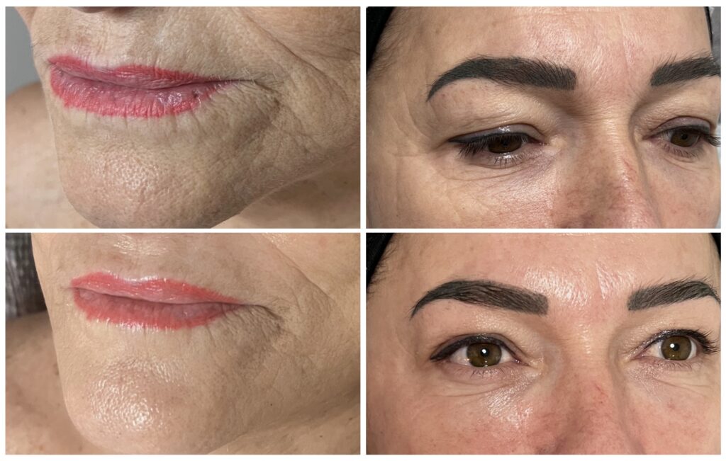 Línea de exosomas premium OVACO en Carmen Pérez Estética Avanzada